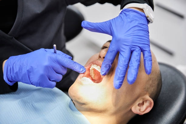 Best Emergency Dentist for Knocked-Out Tooth in Roselle Park, NJ